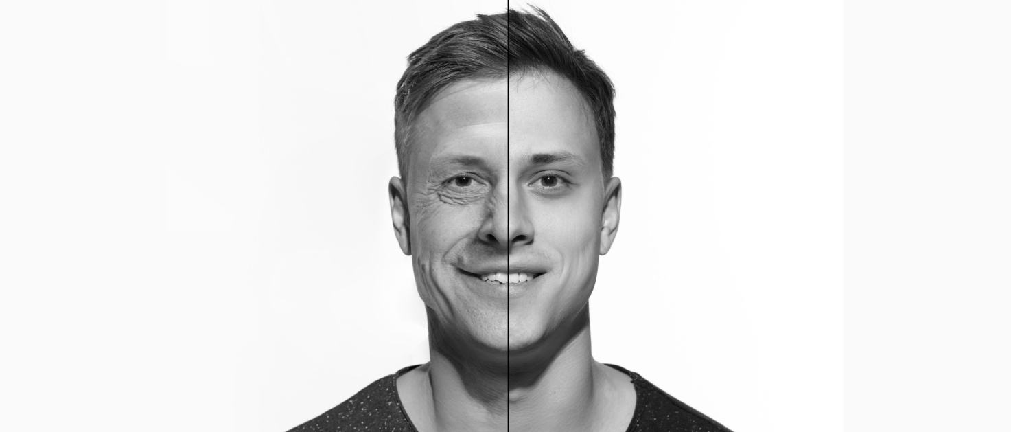 THINGS TO CONSIDER WHEN USING COLLAGEN